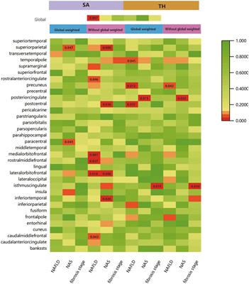 Non-alcoholic fatty liver disease causally affects the brain cortical structure: a Mendelian randomization study